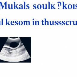 what is msk ultrasound